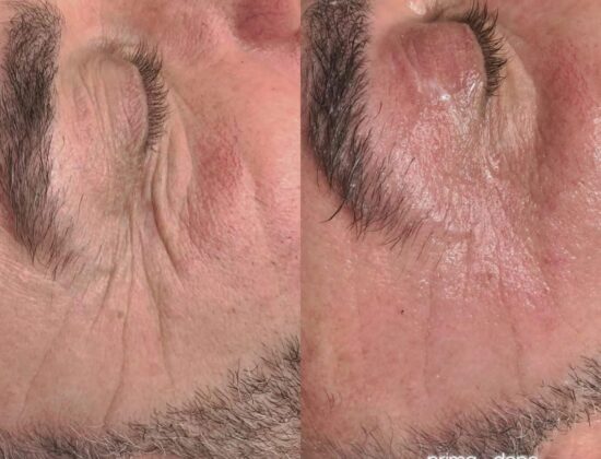 Centro Estetico Edonè – Parrucchiere Roma