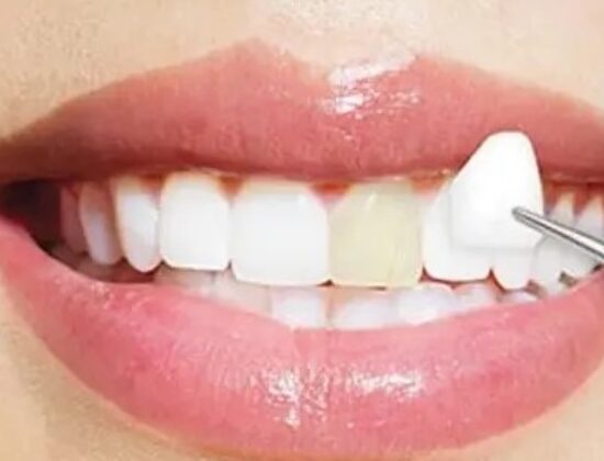 Studio Dentistico Moreno Berrueri